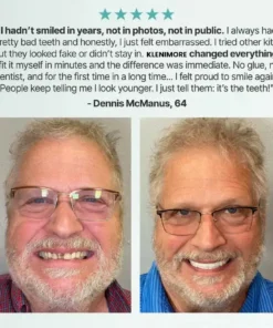 KLENIMORE™ Medical Full Denture with Strong Suction