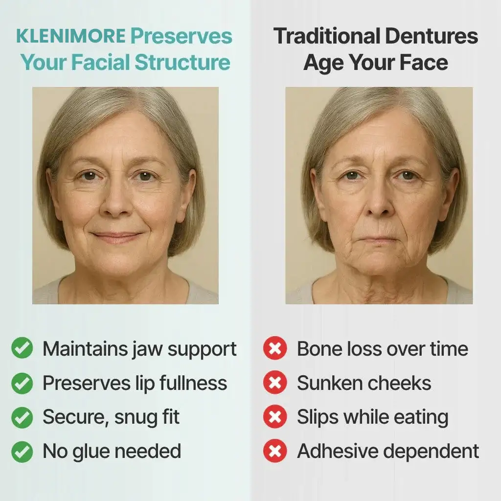 KLENIMORE™ Custom-Fit Fully Functional Dentures