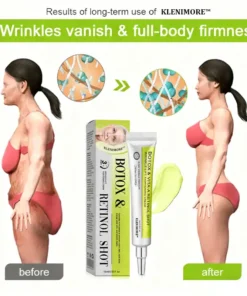 KLENIMORE™ Botox Vitamin A Retinol Anti-Wrinkle Firming and Lifting Cream Last Day for Limited Time 70 OFF