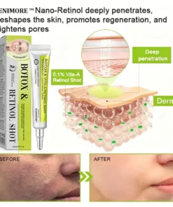 KLENIMORE™ Botox Vitamin A Retinol Anti-Wrinkle Firming and Lifting Cream Last Day for Limited Time 70 OFF