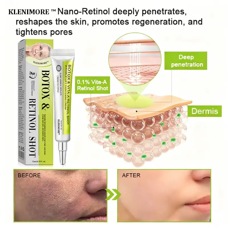 KLENIMORE™ Botox Vitamin A Retinol Anti-Wrinkle Firming and Lifting Cream Last Day for Limited Time 70 OFF