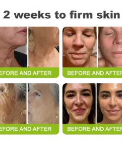 KLENIMORE™ Botox Vitamin A Retinol Anti-Wrinkle Firming and Lifting Cream Last Day for Limited Time 70 OFF