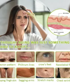 KLENIMORE™ Botox Vitamin A Retinol Anti-Wrinkle Firming and Lifting Cream Last Day for Limited Time 70 OFF