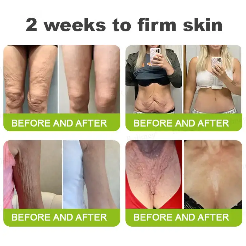 KLENIMORE™ Botox Vitamin A Retinol Anti-Wrinkle Firming and Lifting Cream Last Day for Limited Time 70 OFF