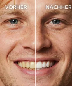 KLENIMORE™ Tooth Polish - Instant Clean Smile