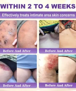 KLENIMORE™ Biotin 10-in-1 Skin Restoration Cream