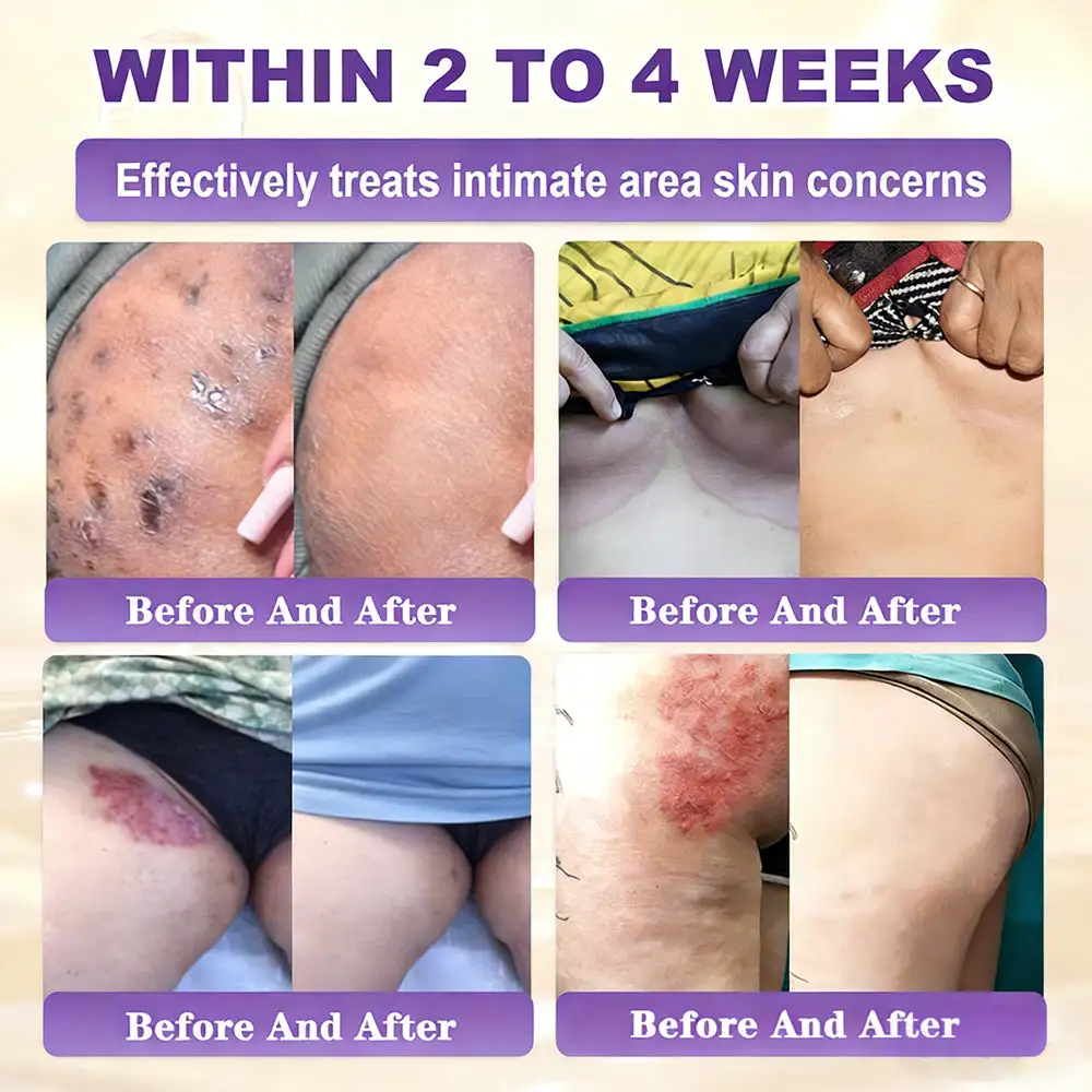 KLENIMORE™ Biotin 10-in-1 Skin Restoration Cream