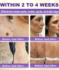 KLENIMORE™ Biotin 10-in-1 Skin Restoration Cream