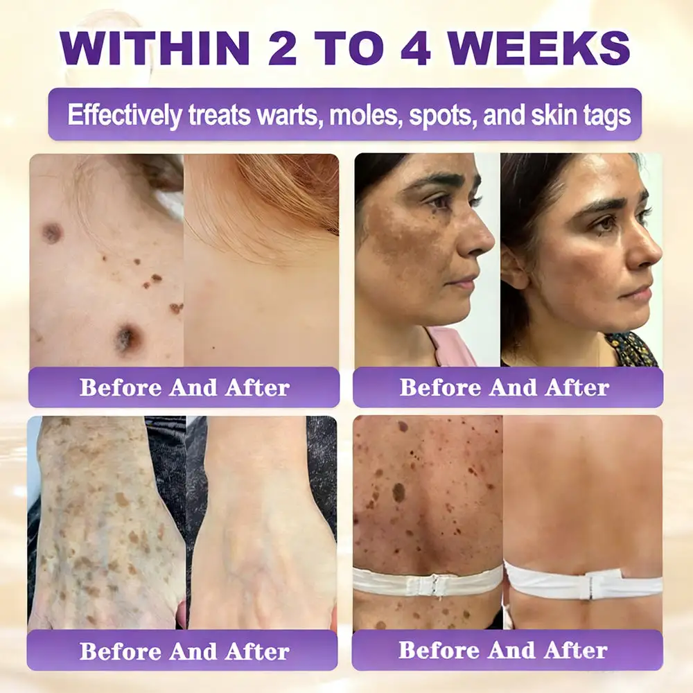 KLENIMORE™ Biotin 10-in-1 Skin Restoration Cream