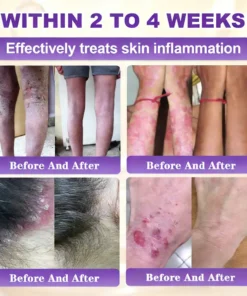 KLENIMORE™ Biotin 10-in-1 Skin Restoration Cream