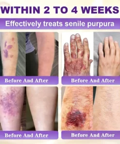 KLENIMORE™ Biotin 10-in-1 Skin Restoration Cream