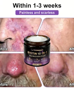 KLENIMORE™ Biotin 10-in-1 Skin Restoration Cream