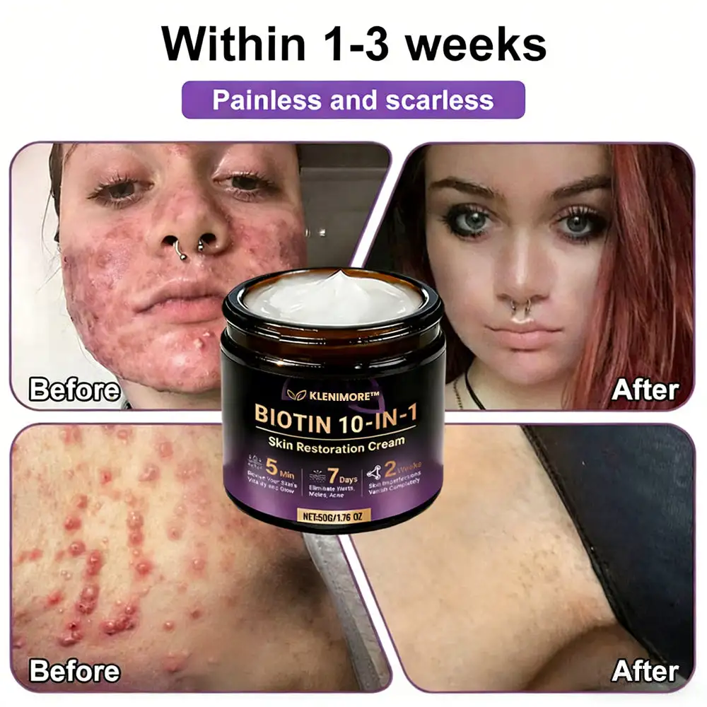 KLENIMORE™ Biotin 10-in-1 Skin Restoration Cream