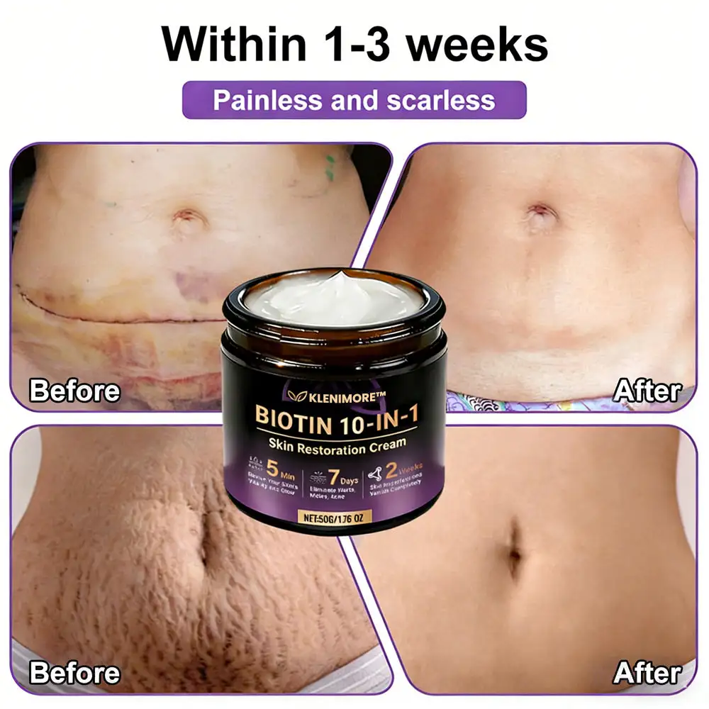 KLENIMORE™ Biotin 10-in-1 Skin Restoration Cream