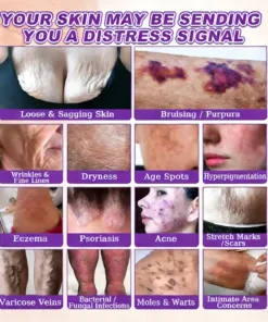 KLENIMORE™ Biotin 10-in-1 Skin Restoration Cream