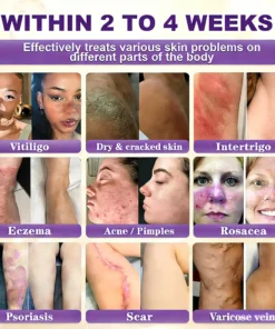 KLENIMORE™ Biotin 10-in-1 Skin Restoration Cream