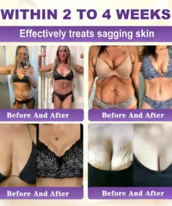 KLENIMORE™ Biotin 10-in-1 Skin Restoration Cream