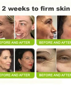 KLENIMORE™ Botox Vita-A Retinol Shot Wrinkle-Lift Tightening cream - Last Day Promotion 70 OFF