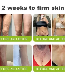 KLENIMORE™ Botox Vita-A Retinol Shot Wrinkle-Lift Tightening cream - Last Day Promotion 70 OFF