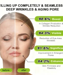 KLENIMORE™ Botox Vita-A Retinol Shot Wrinkle-Lift Tightening cream - Last Day Promotion 70 OFF