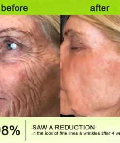 KLENIMORE™ Botox Vita-A Retinol Shot Wrinkle-Lift Tightening cream - Last Day Promotion 70 OFF