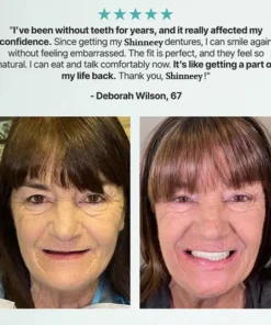 KLENIMORE™ Custom Fit for a Fresh Smile, Say Goodbye to Wearing Discomfort!