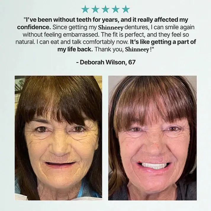 KLENIMORE™ Custom Fit for a Fresh Smile, Say Goodbye to Wearing Discomfort!