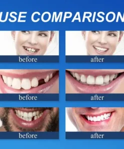 KLENIMORE™ Medical Full Denture with Strong Suctiond