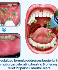 KLENIMORE™ NanoHAP Tooth Polish - Instant Clean Smile