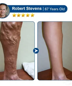 KLENIMORE® 𝑽𝗲𝗶𝙣 𝘾𝐨𝐧𝘁𝗼𝙪𝙧 𝙈𝙞𝐜𝐫𝒐𝒏𝒆𝗲𝗱𝗹𝙚 𝙋𝙖𝐭𝐜𝒉