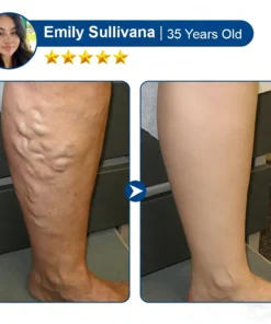 KLENIMORE® 𝑽𝗲𝗶𝙣 𝘾𝐨𝐧𝘁𝗼𝙪𝙧 𝙈𝙞𝐜𝐫𝒐𝒏𝒆𝗲𝗱𝗹𝙚 𝙋𝙖𝐭𝐜𝒉