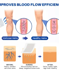 KLENIMORE® 𝑽𝗲𝗶𝙣 𝘾𝐨𝐧𝘁𝗼𝙪𝙧 𝙈𝙞𝐜𝐫𝒐𝒏𝒆𝗲𝗱𝗹𝙚 𝙋𝙖𝐭𝐜𝒉