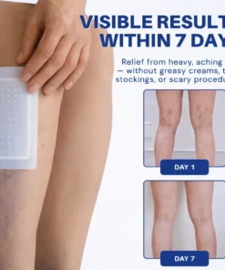 KLENIMORE® 𝑽𝗲𝗶𝙣 𝘾𝐨𝐧𝘁𝗼𝙪𝙧 𝙈𝙞𝐜𝐫𝒐𝒏𝒆𝗲𝗱𝗹𝙚 𝙋𝙖𝐭𝐜𝒉