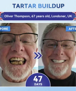 KLENIMORE® 🦷 Tideglusib Fast‑Dissolving Tooth & Gum Repair Oral Strips