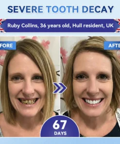 KLENIMORE® 🦷 Tideglusib Fast‑Dissolving Tooth & Gum Repair Oral Strips