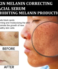 KLENIMORE™ Niacinamide Brightening Serum