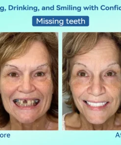 KLENIMORE® Premium Denture AdaptableFit Functional Dentures