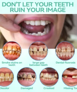 KLENIMORE® Premium Denture AdaptableFit Functional Dentures