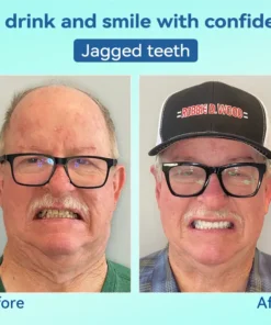 KLENIMORE® Premium Denture AdaptableFit Functional Dentures