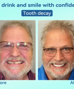 KLENIMORE® Premium Denture AdaptableFit Functional Dentures