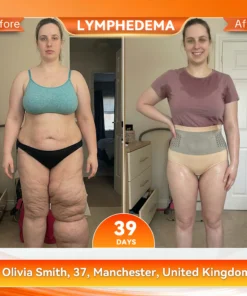 KLENIMORE® 𝟐𝟎𝟐𝟔 𝐌𝐨𝐫𝐢𝐧𝐠𝐚 & 𝐁𝐞𝐫𝐛𝐞𝐫𝐢𝐧𝐞 𝟒-𝐈𝐧-𝟏 𝐌𝐢𝐜𝐫𝐨-𝐏𝐚𝐫𝐭𝐢𝐜𝐥𝐞 𝐒𝐜𝐮𝐥𝐩𝐭𝐢𝐧𝐠 & 𝐅𝐚𝐭-𝐁𝐮𝐫𝐧 𝐒𝐡𝐨𝐫𝐭𝐬
