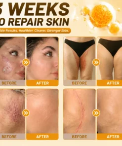 KLENIMORE® Bee Poison Skin Restoration Cream