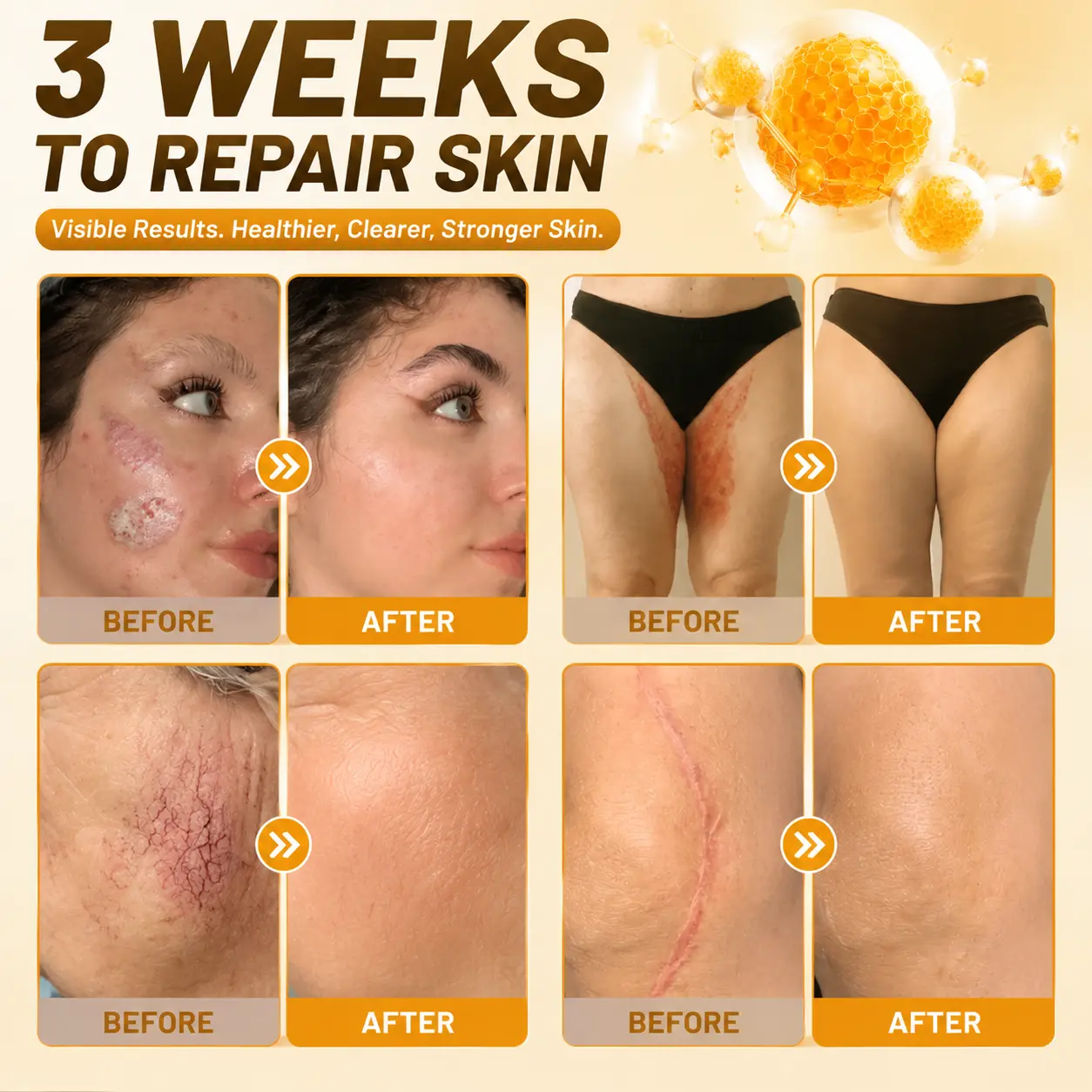 KLENIMORE® Bee Poison Skin Restoration Cream