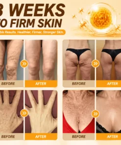 KLENIMORE® Bee Poison Skin Restoration Cream
