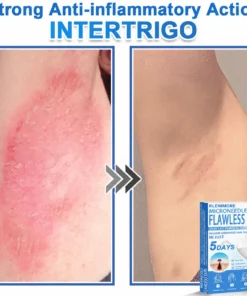 KLENIMORE™ 2-in-1 Hydrocolloid Pimple Patches