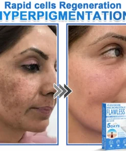 KLENIMORE™ 2-in-1 Hydrocolloid Pimple Patches