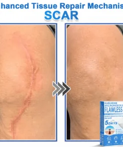 KLENIMORE™ 2-in-1 Hydrocolloid Pimple Patches