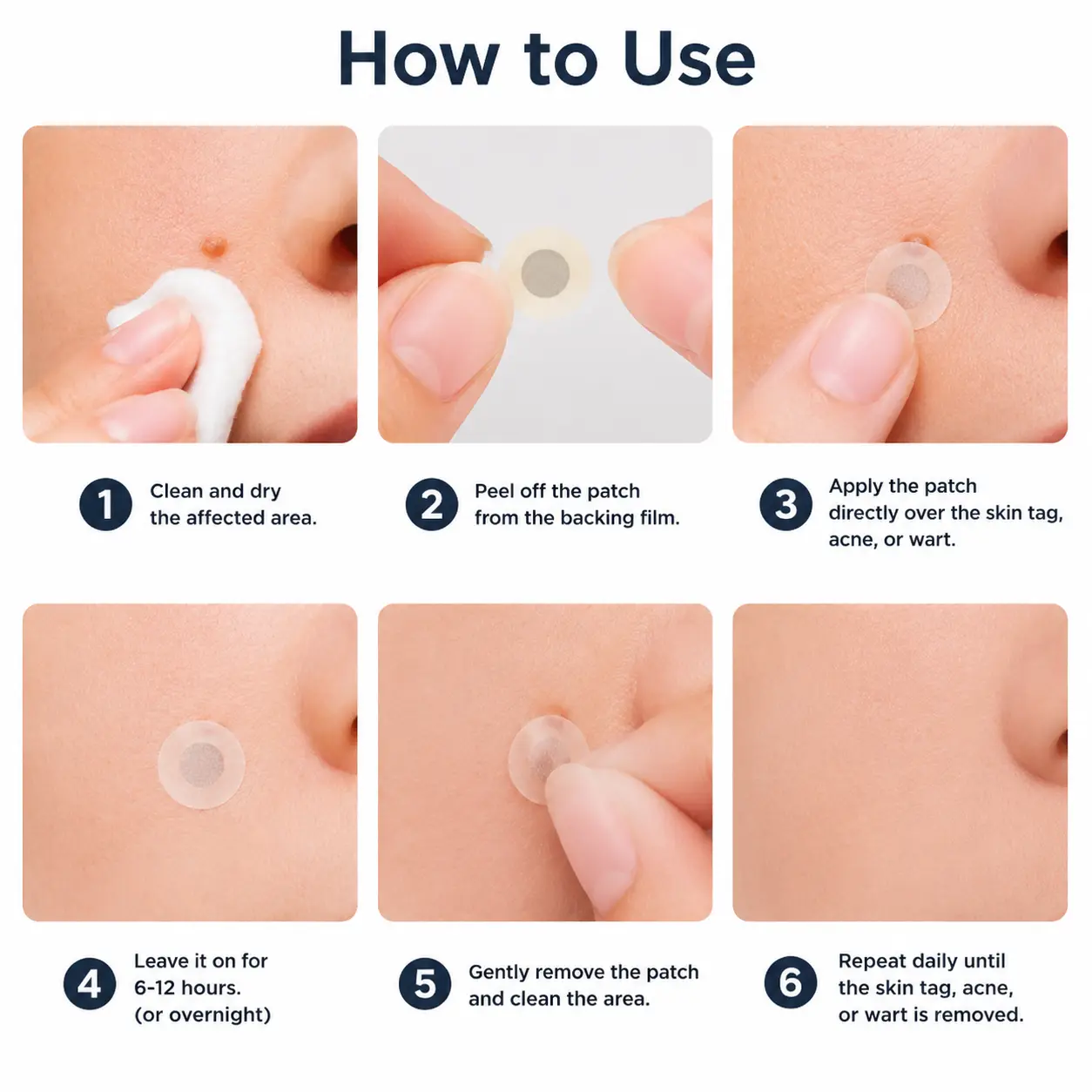 KLENIMORE™ 2-in-1 Microneedle & Hydrocolloid Patch
