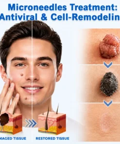 KLENIMORE™ 2-in-1 Microneedle & Hydrocolloid Patch