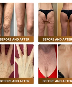 KLENIMORE™ Botox & Bee Venom Advanced Recovery Cream